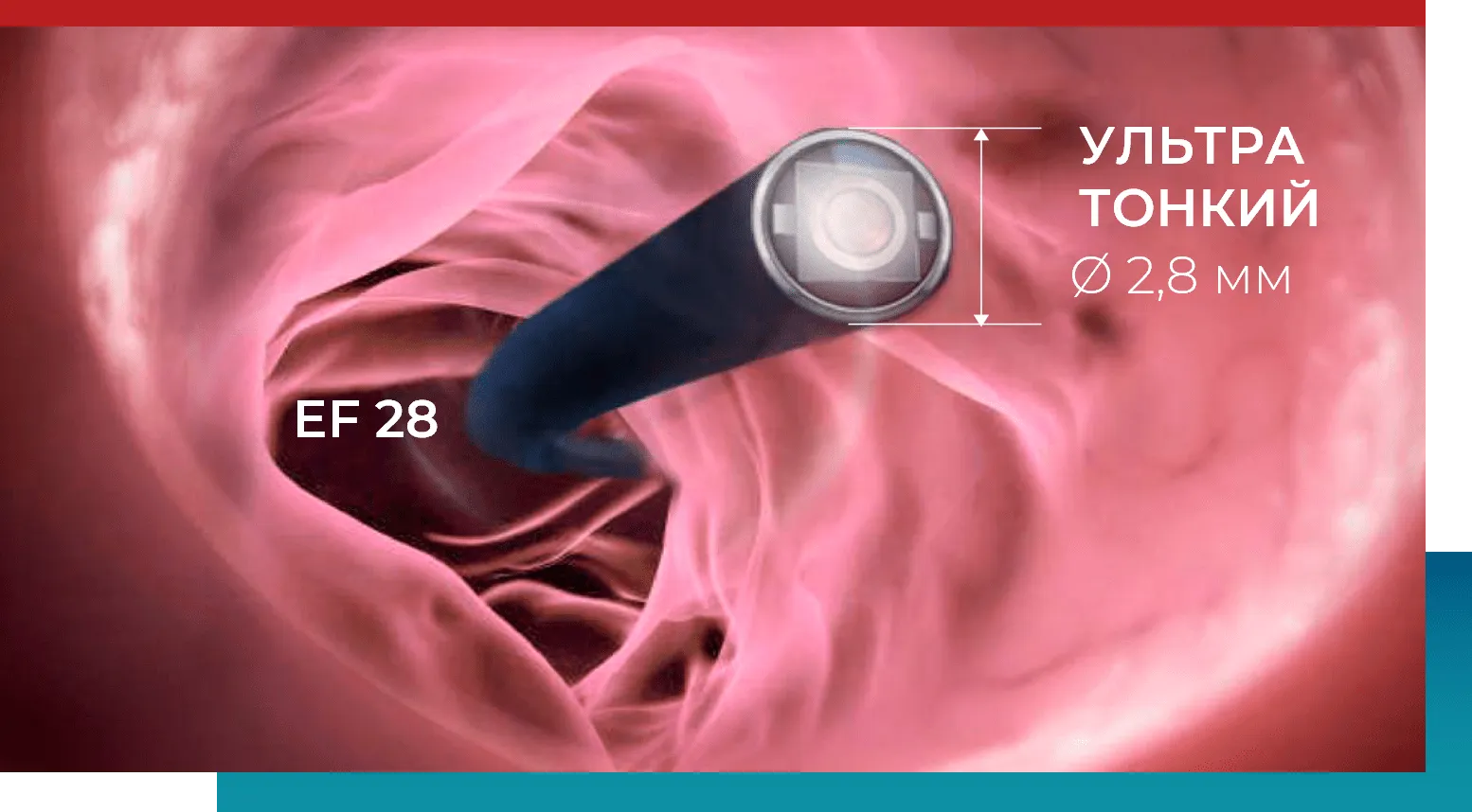 Характеристики видеориноларингоскопа EF28
