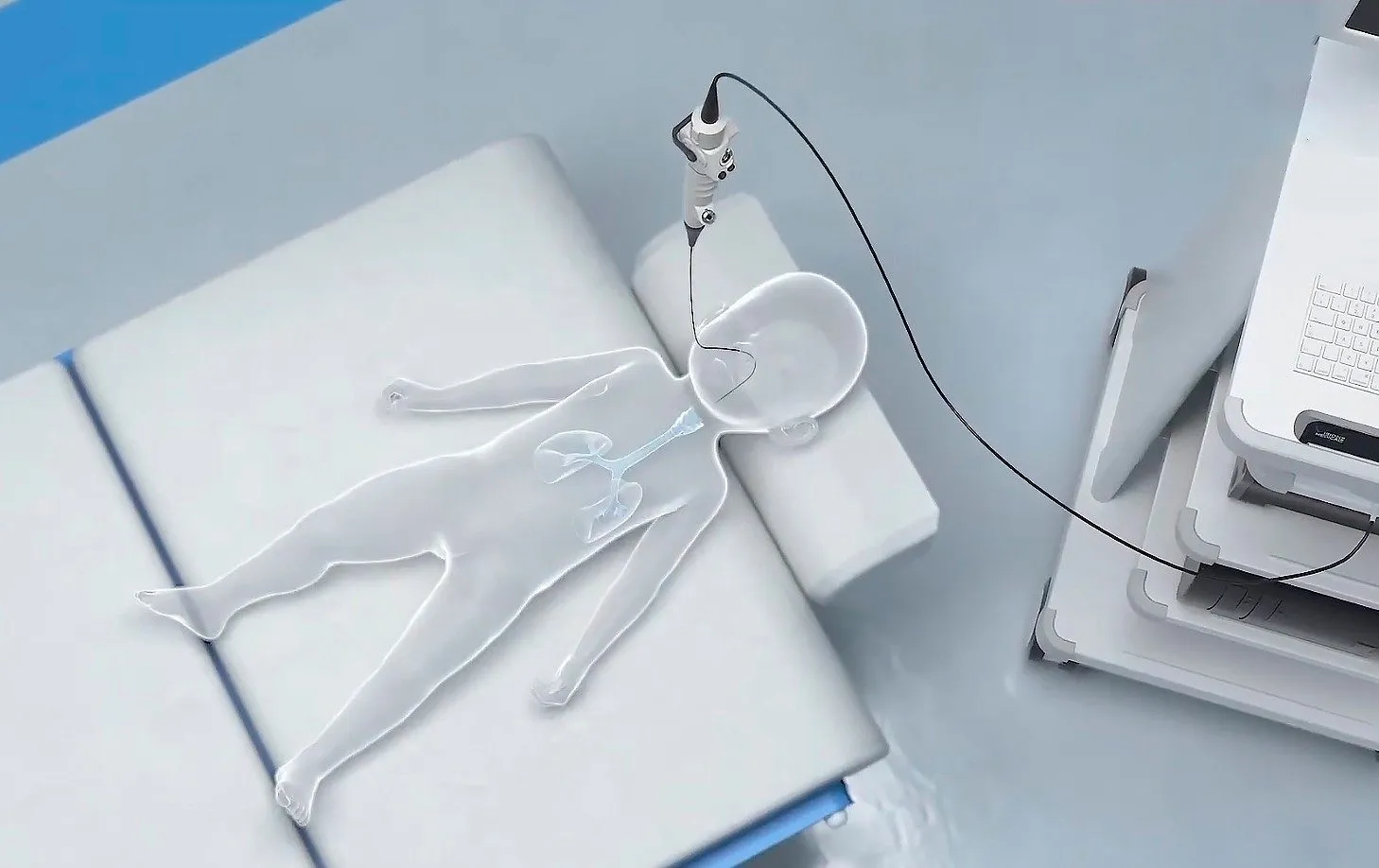 Позволяет обследовать даже новорожденных!