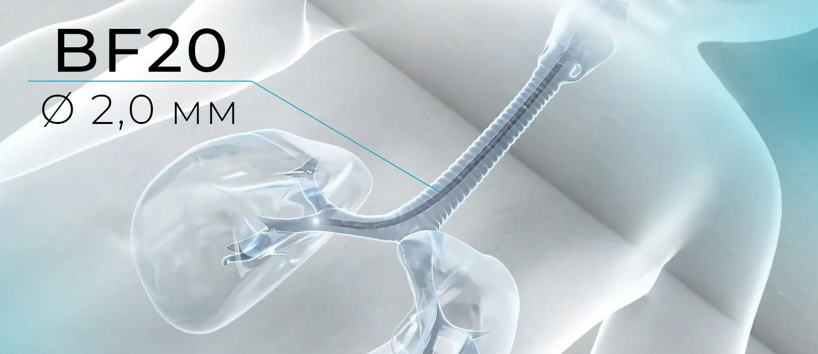 Позволяет обследовать даже новорожденных
